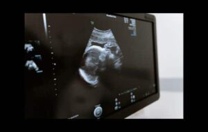 ¿Es confiable un test de embarazo por celular?